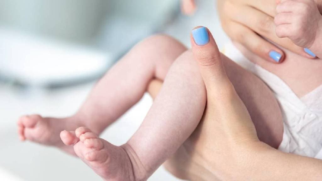 Take care of your newborn baby’s skin
