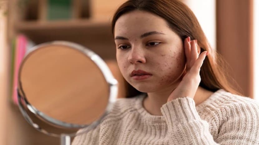 diy skin care benefits of potato face packs homemade potato face pack good for skin
