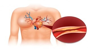Health Flaxseeds Reduced Bad Cholesterol