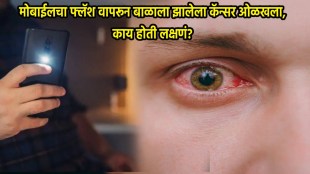 Mom Finds Three Month Old Baby Rarest Cancer In Eyes By Mobile Flash Light What Are Signs Of Cancer Seen In Eyes Be Alert
