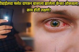 Mom Finds Three Month Old Baby Rarest Cancer In Eyes By Mobile Flash Light What Are Signs Of Cancer Seen In Eyes Be Alert