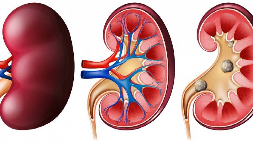 Kidney Health Human Can Survive With One Kidneys 