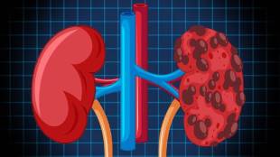 Kidney Health Human Can Survive With One Kidneys