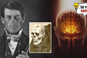 Phineas Gage skull accident