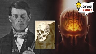 Phineas Gage skull accident
