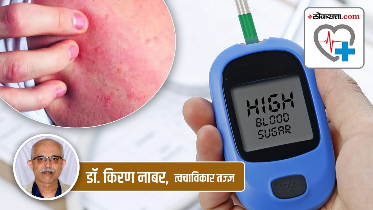loksatta Health Special article, relationship between, skin disorders, diabetes