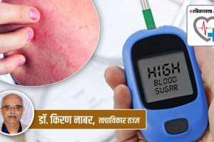 loksatta Health Special article, relationship between, skin disorders, diabetes