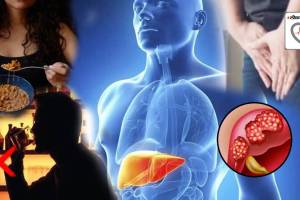 Fatty Liver Can Happen Without Drinking Alcohol Check These Changes Signs