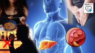 Fatty Liver Can Happen Without Drinking Alcohol Check These Changes Signs