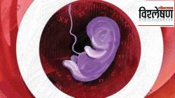 गर्भधारणेनंतर ३० आठवड्यांपर्यंत गर्भपातास परवानगी, सर्वोच्च न्यायालयाचा निर्णय; भारतीय गर्भपात कायदा काय आहे?