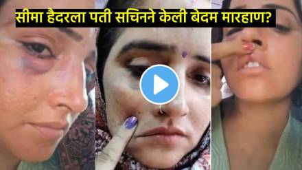 seema haider with swollen eye lip injury goes viral amid reports of fight with husband sachin deepfake ai video viral