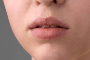 remedies beauty tips for dry lips