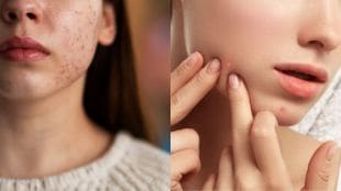 Skin-Care-Tips