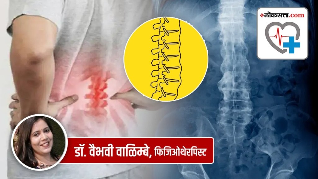 ankylosing spondylitis in marathi, what is ankylosing spondylitis in marathi