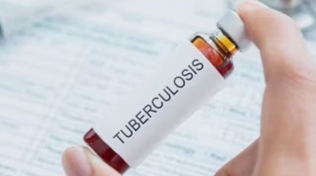 tuberculosis marathi news, tuberculosis genetic sequencing marathi news