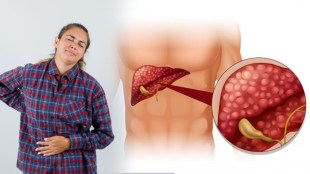 fatty-liver-symptoms