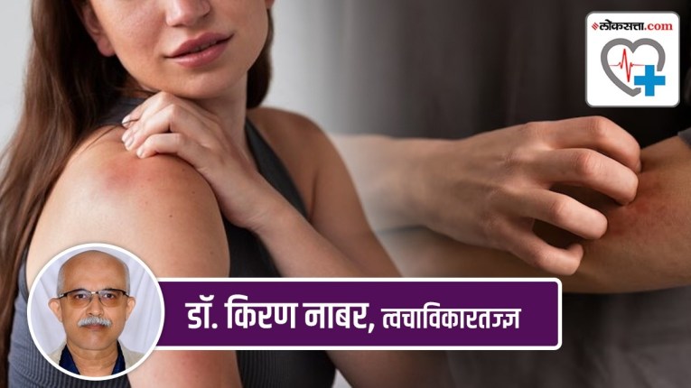 Health Special: अंगभर खाज येते व पुरळ कुठेच नाही… ‘ही’ असू शकते गंभीर आजाराची सुरुवात!