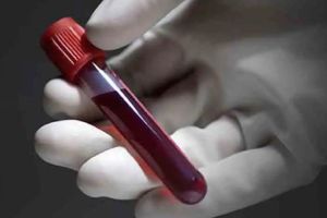 minors Both blood samples revealed no alcohol
