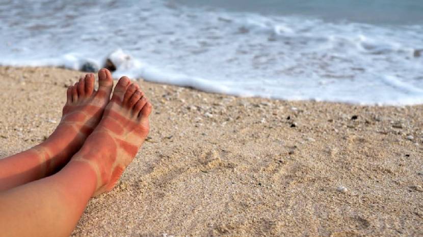 Home Remedies For Tanned Skin Of Hands And Legs