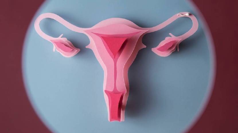 Symptoms of Ovarian Cancer