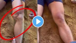 athletes sprained knee repaired in seconds netizens are speechless after seeing the trainers technique in viral video