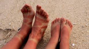 Home Remedies For Tanned Feet