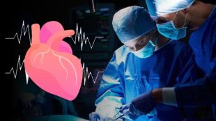 Congenital heart disease baby got life Successful treatment by balloon aortoplasty procedure