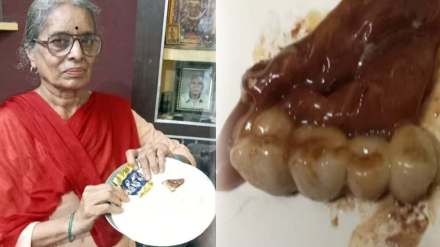 mp woman finds 4 false teeth in chocolate received at childs birthday gift