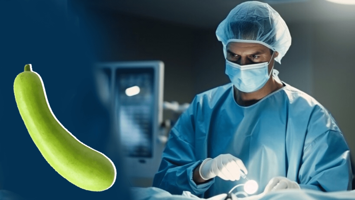 Doctors removed 16 inch bottle gourd from 60 year old mans rectum in mp