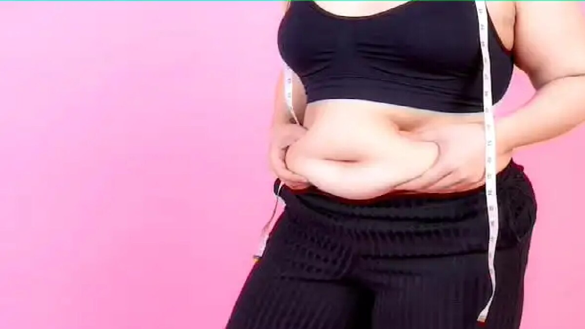 Twelve year girl rescued from obesity Treatment by bariatric surgery pune print news