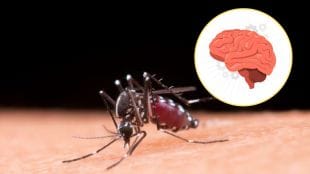 Dengue impact on the brain