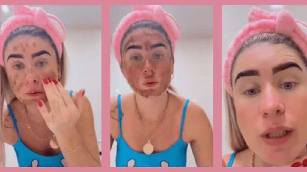 Brazilian influencer uses poop face mask in skincare routine