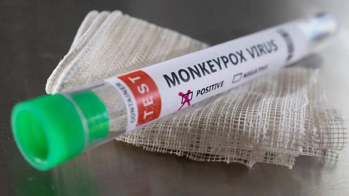 Keeping in view speed of monkeypox infection Public Health Department released guidelines