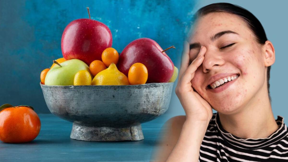 apples good for acne