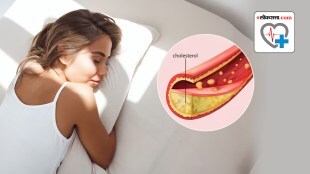 Cholesterol and Diabetes