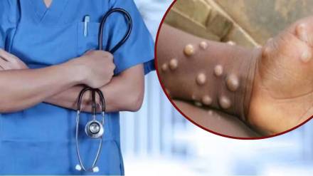monkeypox virus global emergency Cases found in Sweden, Pakistan; Symptoms, transmission