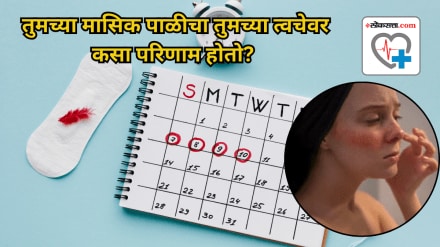 How does your menstrual cycle affect your skin We asked a dermatologist