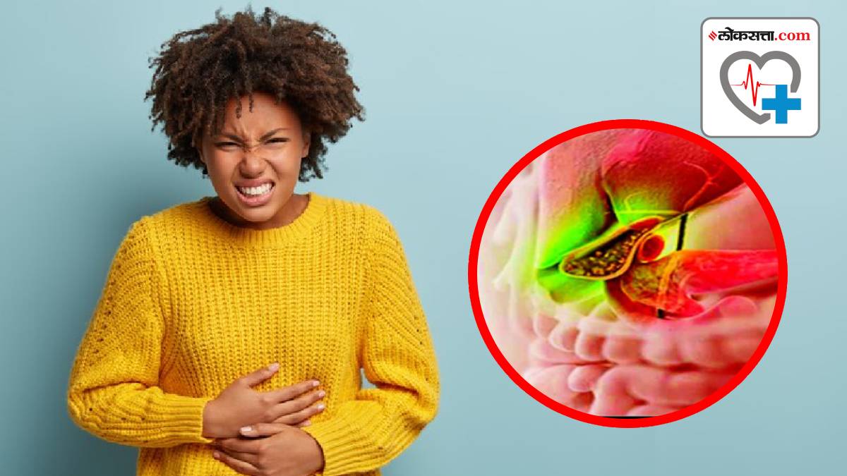 Natural Ways To Dissolve Gall bladder Stones