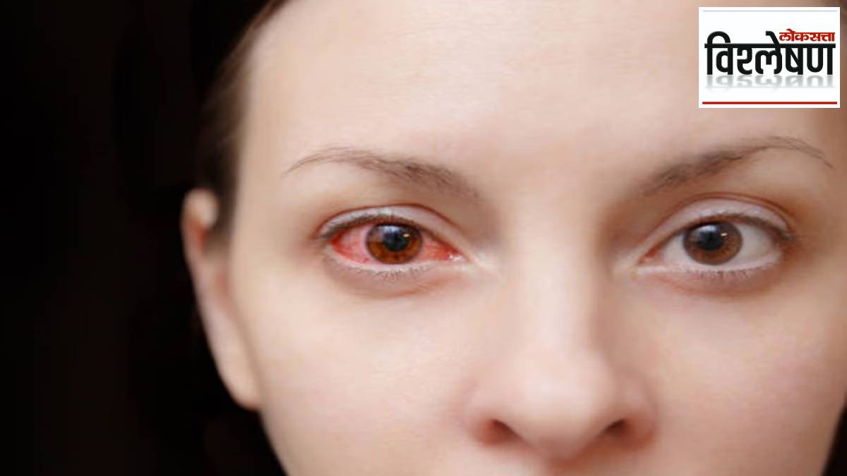 about symptoms treatment vaccine for Bleeding eye disease