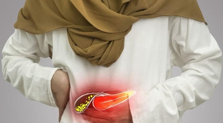 Kidney and Gallbladder Stones