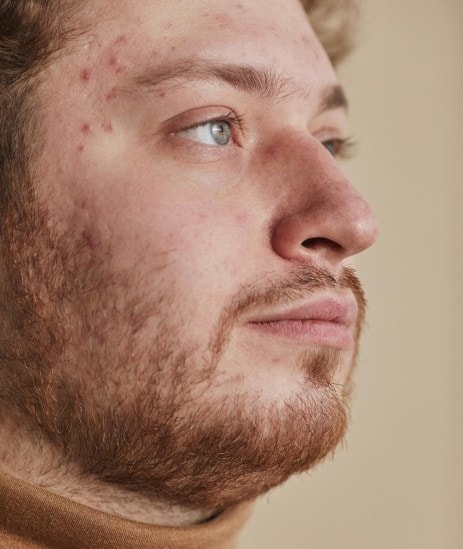 Skincare routine for men