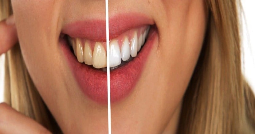 teeth whitening tips in marathi