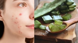 9 Powerful Aloe Vera Remedies for Naturally Glowing and Clear Skin at Home