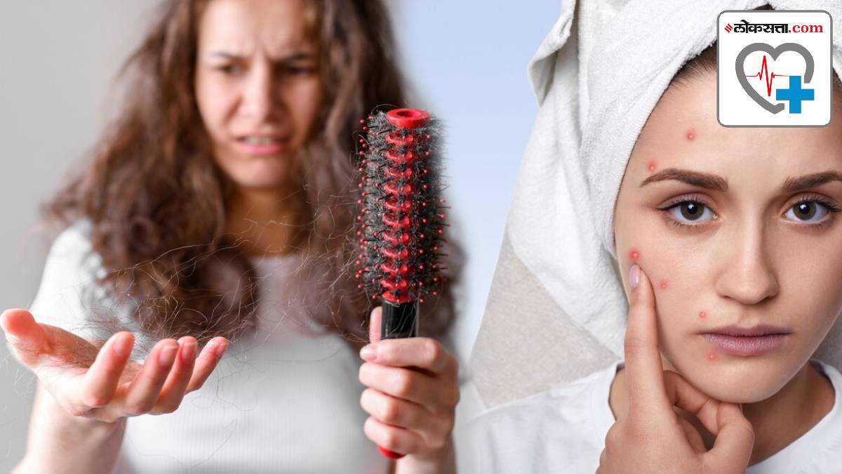If your Hair Fall value increasing day by day then stop eating these five foods