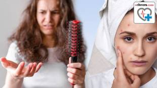 If your Hair Fall value increasing day by day then stop eating these five foods