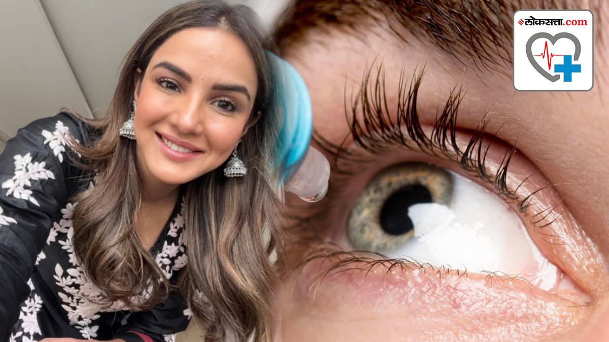 What role does the cornea play