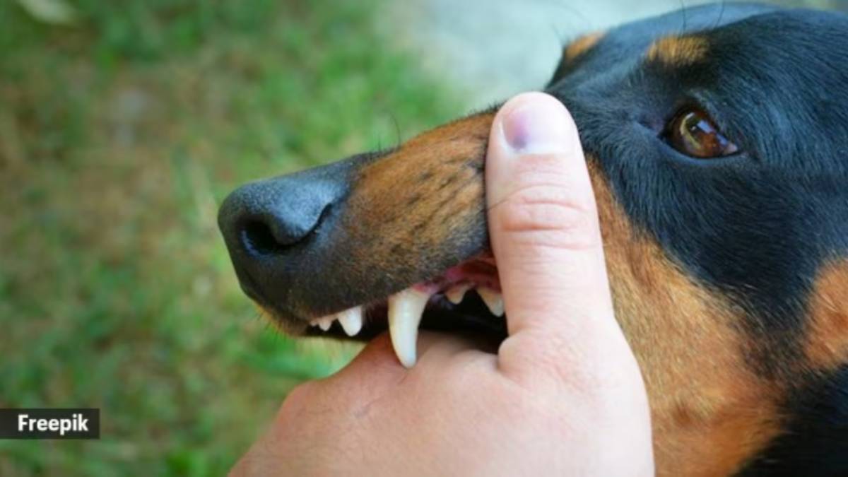 police file case on owner for rottweiler dog attack
