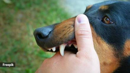 police file case on owner for rottweiler dog attack