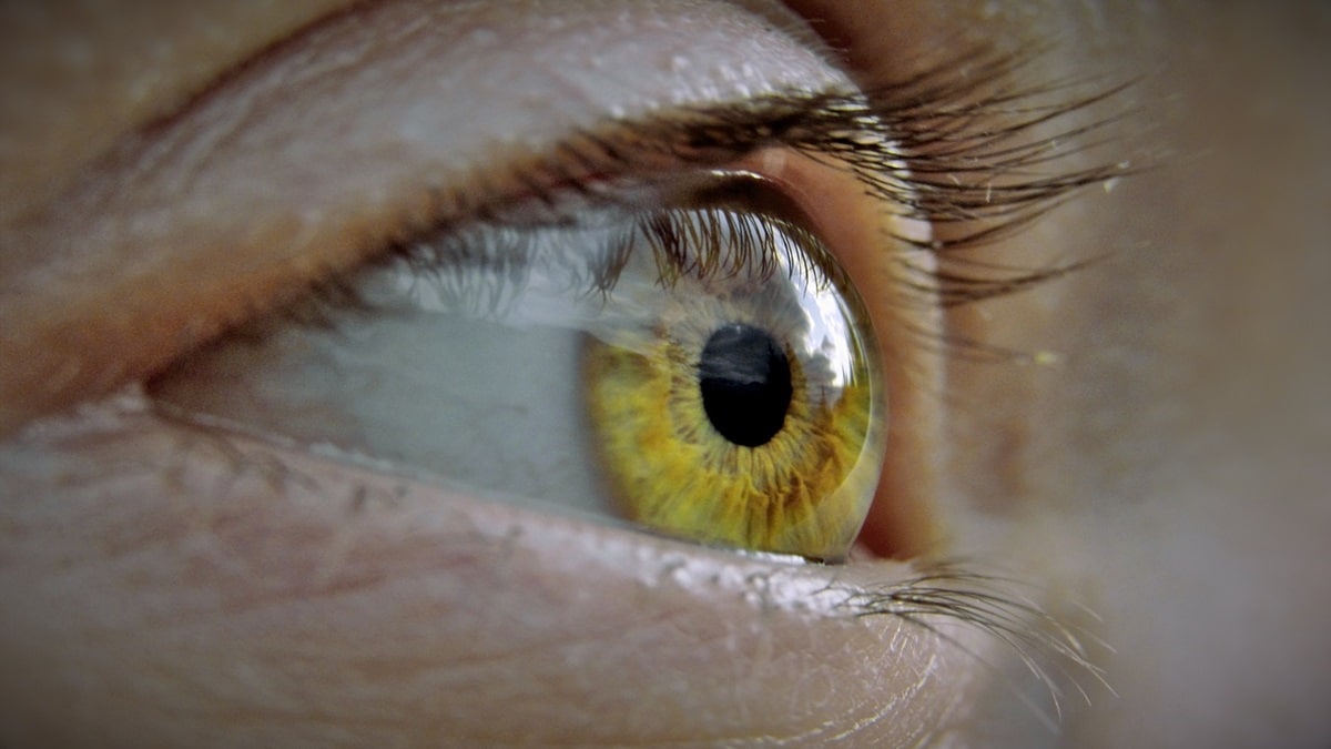eye infections, Rising temperatures, Doctor ,