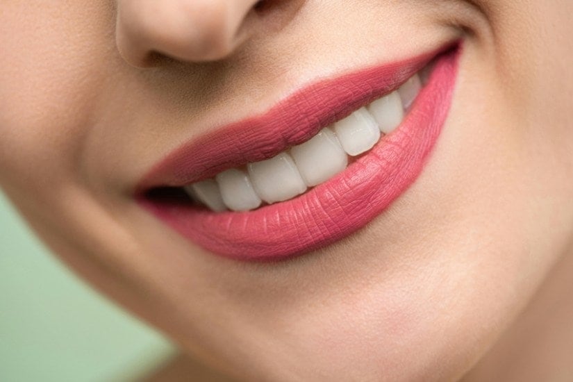 black stains on teeth
